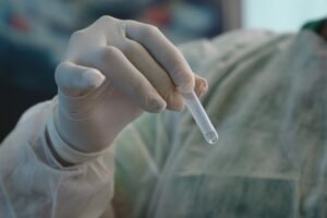 Cenário epidemiológico da Covid-19 no Amazonas é divulgado pela FVS-RCP, nesta terça-feira (14/09)
