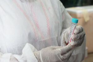 Cenário epidemiológico da Covid-19 no Amazonas é divulgado pela FVS-RCP, neste domingo (09/01)
