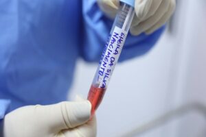 Panorama epidemiológico da Covid-19 no Amazonas é divulgado pela FVS-RCP, neste domingo (16/01)