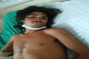 HPS João Lúcio procura familiares de paciente internado na unidade vítima de agressão