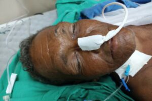 HPS João Lúcio procura familiares de paciente internado na unidade