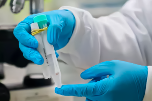 Mpox: Informe epidemiológico mensal atualiza situação da doença no Amazonas