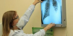 Dia Nacional de Combate à Tuberculose: SES-AM esclarece sobre meios de prevenção, sintomas e tratamento