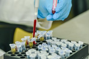 Fundação de Medicina Tropical participa de estudo internacional sobre Tuberculose
