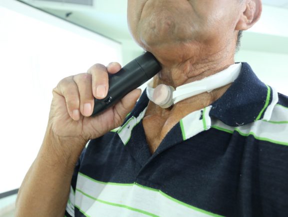 Pacientes da FCecon recebem laringe eletrônica para auxiliar na fala