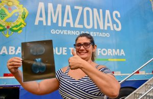 Governo do Amazonas oferta cirurgias ginecológicas e exames para mais de mil mulheres, ne…