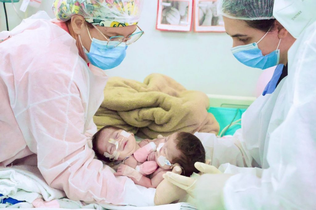 Gemeas siamesas completam 1 ano Foto Divulgacao SES AM